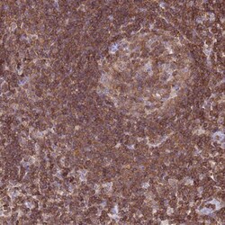 IRF5 Antibody, Novus Biologicals:Antibodies:Primary Antibodies