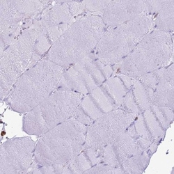 IRF5 Antibody, Novus Biologicals:Antibodies:Primary Antibodies