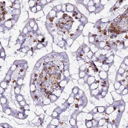 IRF5 Antibody, Novus Biologicals:Antibodies:Primary Antibodies