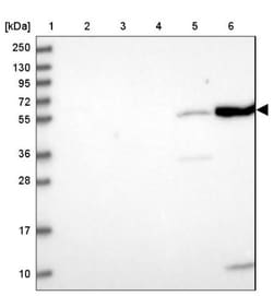 IRF5 Antibody, Novus Biologicals:Antibodies:Primary Antibodies