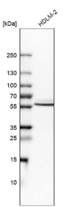 IRF5 Antibody, Novus Biologicals:Antibodies:Primary Antibodies