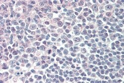 IRF8 Antibody, Novus Biologicals 0.1mg; Unlabeled:Antibodies, Polyclonal