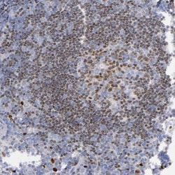 IRF8 Antibody, Novus Biologicals:Antibodies:Primary Antibodies