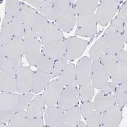 IRF8 Antibody, Novus Biologicals:Antibodies:Primary Antibodies