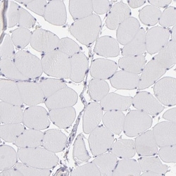 IRF8 Antibody, Novus Biologicals 0.1mL; Unlabeled:Antibodies, Polyclonal
