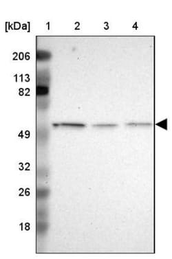 IRF8 Antibody, Novus Biologicals 0.1mL; Unlabeled:Antibodies, Polyclonal