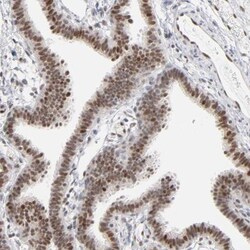 IRF9 Antibody, Novus Biologicals:Antibodies:Primary Antibodies