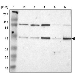 IRF9 Antibody, Novus Biologicals:Antibodies:Primary Antibodies