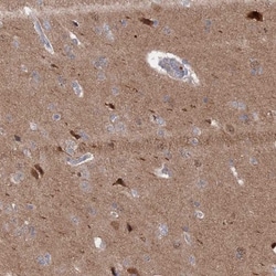IRGQ Antibody, Novus Biologicals 0.1mL; Unlabeled:Antibodies, Polyclonal