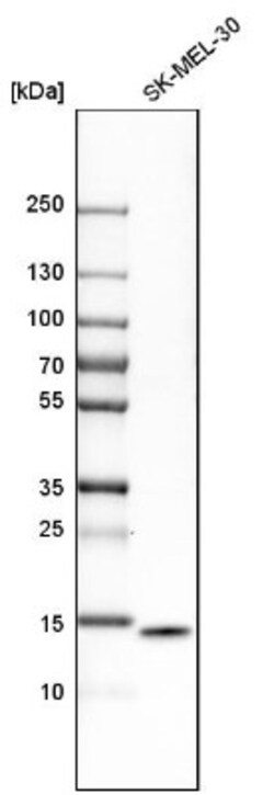 ISG15/UCRP Antibody, Novus Biologicals:Antibodies:Primary Antibodies