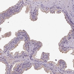 ISLR Antibody, Novus Biologicals 0.1mL; Unlabeled:Antibodies, Polyclonal