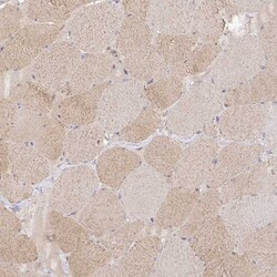 ISLR Antibody, Novus Biologicals 0.1mL; Unlabeled:Antibodies, Polyclonal