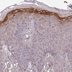 ISLR Antibody, Novus Biologicals 0.1mL; Unlabeled:Antibodies, Polyclonal