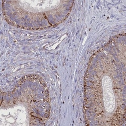 ISOC2 Antibody, Novus Biologicals 25 &mu;L | Buy Online | Novus Biologicals | Fisher Scientific