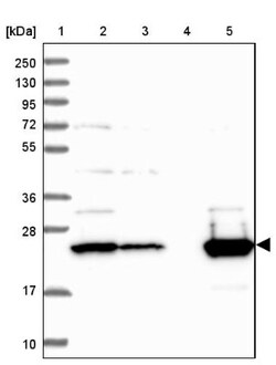 ISOC2 Antibody, Novus Biologicals 25 &mu;L | Buy Online | Novus Biologicals | Fisher Scientific