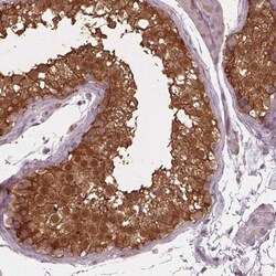 ISYNA1 Antibody, Novus Biologicals:Antibodies:Primary Antibodies