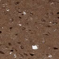 ITFG1 Antibody, Novus Biologicals:Antibodies:Primary Antibodies