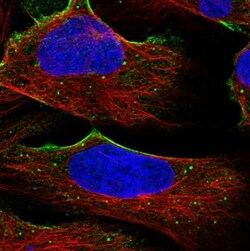 ITIH1 Antibody, Novus Biologicals 0.1mL; Unlabeled:Antibodies, Polyclonal