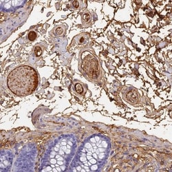 ITIH1 Antibody, Novus Biologicals 0.1mL; Unlabeled:Antibodies, Polyclonal