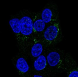 ITIH2 Antibody, Novus Biologicals 25 &mu;L, Unlabeled:Antibodies, Polyclonal
