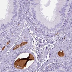 ITIH4 Antibody, Novus Biologicals:Antibodies:Primary Antibodies