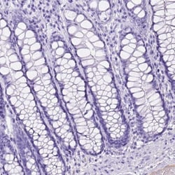 ITIH4 Antibody, Novus Biologicals:Antibodies:Primary Antibodies