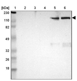 ITIH4 Antibody, Novus Biologicals:Antibodies:Primary Antibodies
