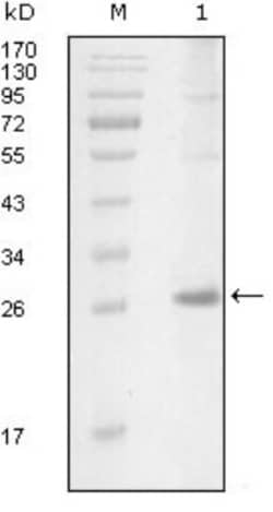 ITK Antibody (5G12C4), Novus Biologicals 0.1mL; Unlabeled:Antibodies, Monoclonal