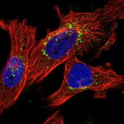 ITM2B Antibody, Novus Biologicals 25 &mu;L; Unlabeled:Antibodies, Polyclonal