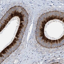 ITM2B Antibody, Novus Biologicals 25 &mu;L; Unlabeled:Antibodies, Polyclonal