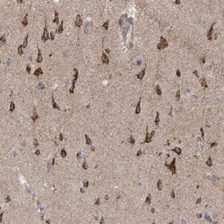 ITM2B Antibody, Novus Biologicals 25 &mu;L; Unlabeled:Antibodies, Polyclonal