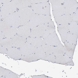 ITM2B Antibody, Novus Biologicals 25 &mu;L; Unlabeled:Antibodies, Polyclonal