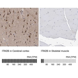 ITM2B Antibody, Novus Biologicals 25 &mu;L; Unlabeled:Antibodies, Polyclonal