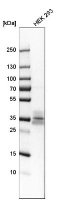 ITM2B Antibody, Novus Biologicals 25 &mu;L; Unlabeled:Antibodies, Polyclonal