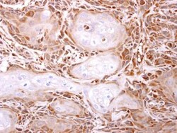 ITPA Antibody, Novus Biologicals 0.1mg; Unlabeled:Antibodies, Polyclonal