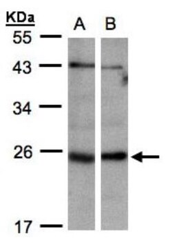 ITPA Antibody, Novus Biologicals 0.1mg; Unlabeled:Antibodies, Polyclonal
