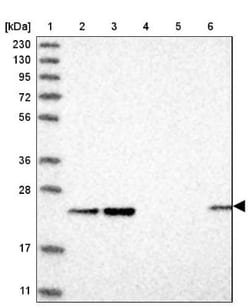 ITPA Antibody, Novus Biologicals 0.1mL; Unlabeled:Antibodies, Polyclonal