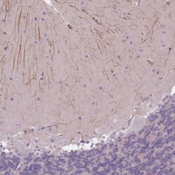 ITPKA Antibody, Novus Biologicals 0.1mL; Unlabeled:Antibodies, Polyclonal