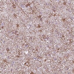 ITPKA Antibody, Novus Biologicals 0.1mL; Unlabeled:Antibodies, Polyclonal