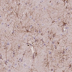 ITPKA Antibody, Novus Biologicals 0.1mL; Unlabeled:Antibodies, Polyclonal