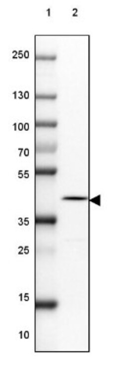 ITPKA Antibody, Novus Biologicals 0.1mL; Unlabeled:Antibodies, Polyclonal