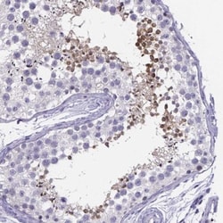 IZUMO1 Antibody, Novus Biologicals:Antibodies:Primary Antibodies