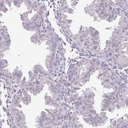IZUMO4 Antibody, Novus Biologicals 25 &mu;L, Unlabeled:Antibodies, Polyclonal