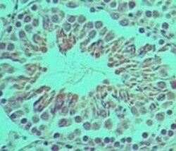 Ifi204 Antibody, Novus Biologicals 0.1mg; Unlabeled:Antibodies, Polyclonal