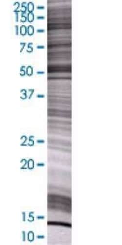 Novus Biologicals Ig gamma-4 Chain C Region 293T Cell Transient Overexpression Lysate 0.1 mL | Buy Online | Novus Biologicals&trade; | Fisher Scientific