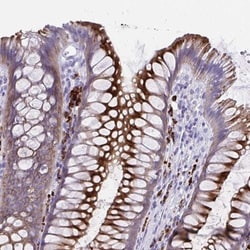 IgJ Antibody, Novus Biologicals:Antibodies:Primary Antibodies