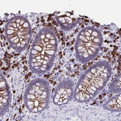 IgJ Antibody, Novus Biologicals:Antibodies:Primary Antibodies