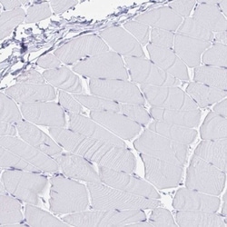 IgJ Antibody, Novus Biologicals:Antibodies:Primary Antibodies
