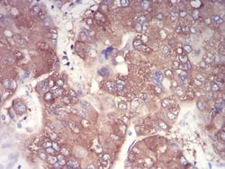 IkB-alpha Antibody (4D4C4) - BSA Free, Novus Biologicals:Antibodies:Primary