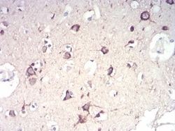 IkB-alpha Antibody (4D4C4) - BSA Free, Novus Biologicals:Antibodies:Primary